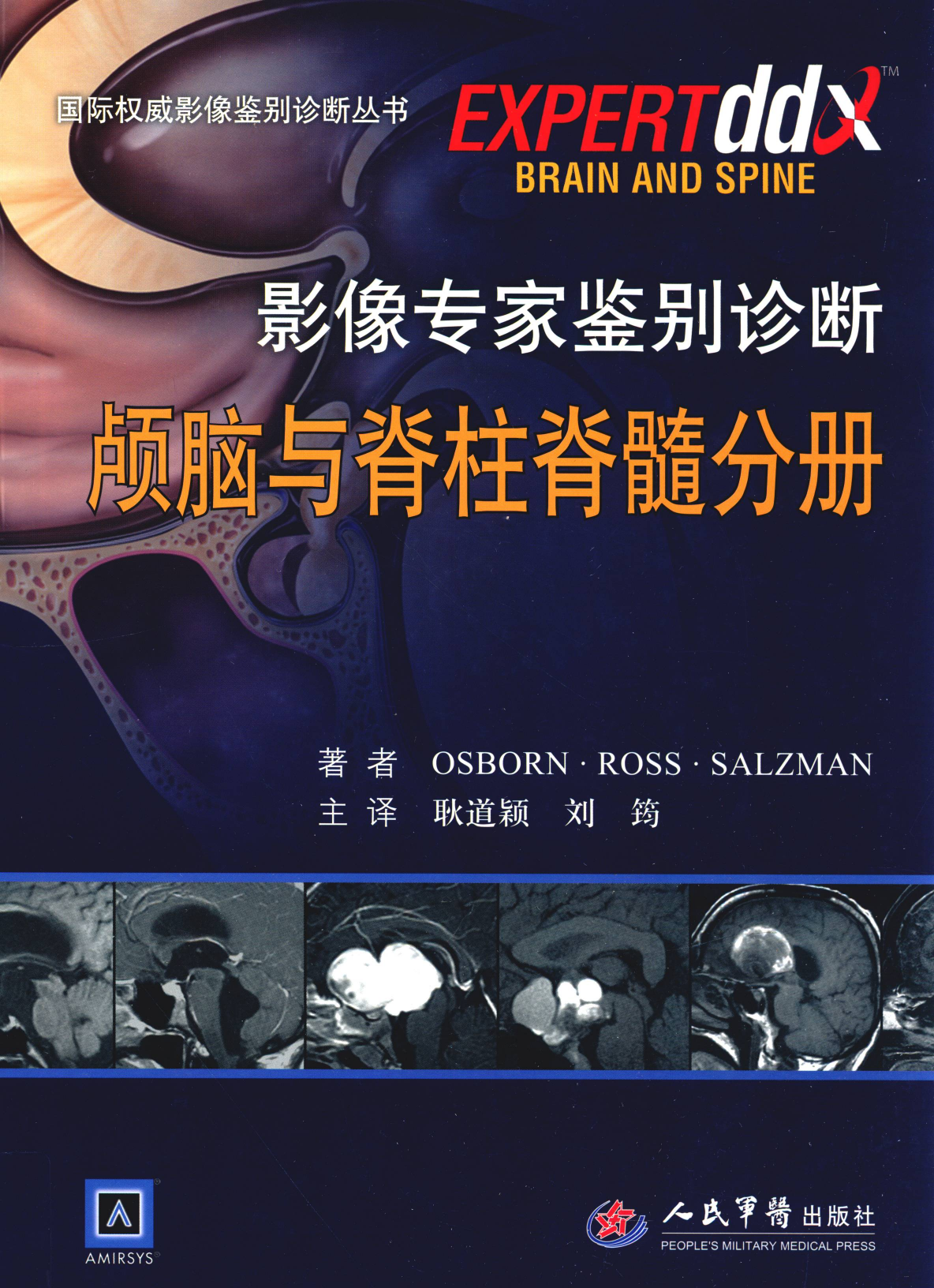 影像专家鉴别诊断-颅脑与脊柱脊髓分册——Osborn·Ross·Salzman-2012（精品、清晰、好书）