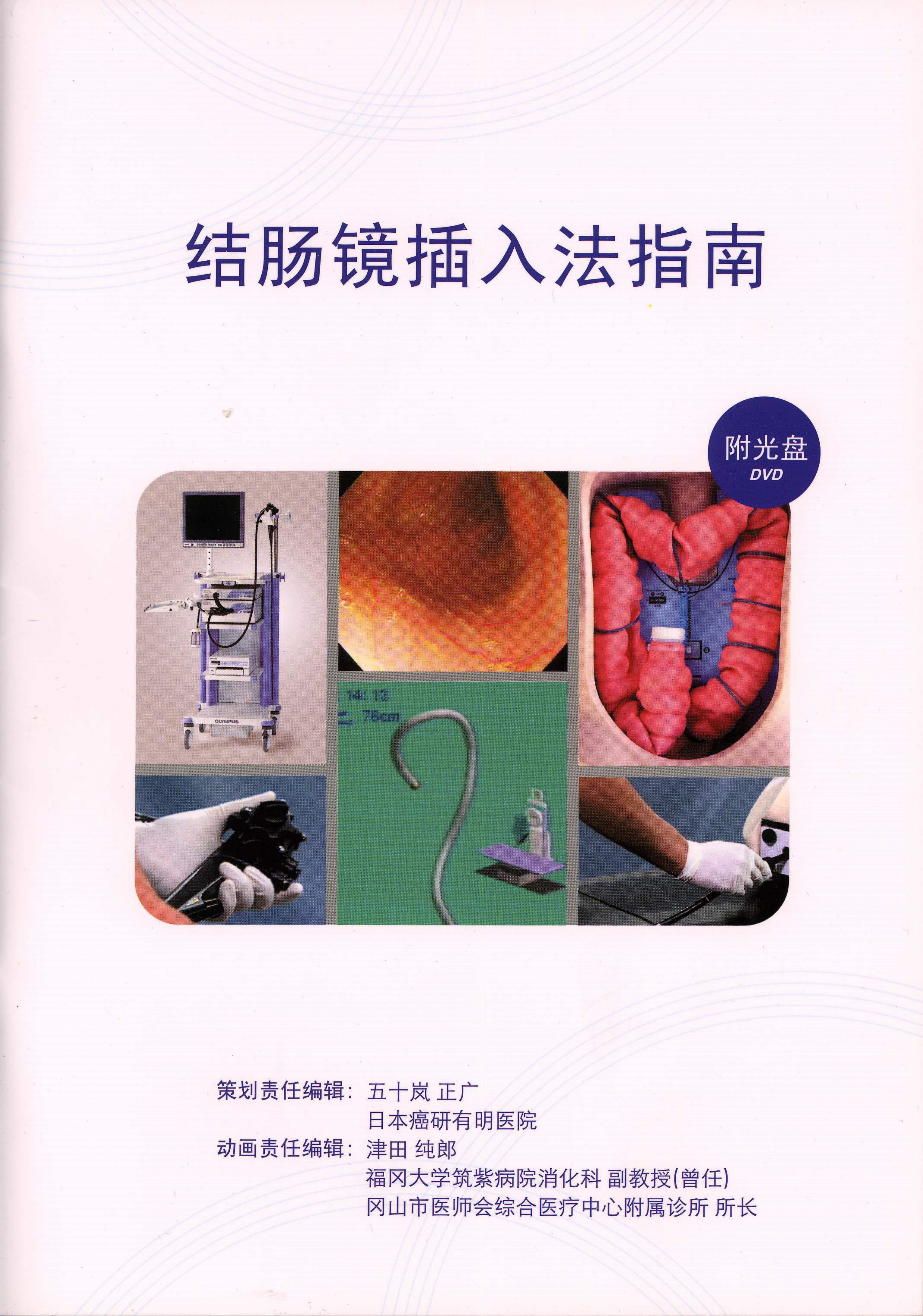 欧林巴斯结肠镜插入法指南